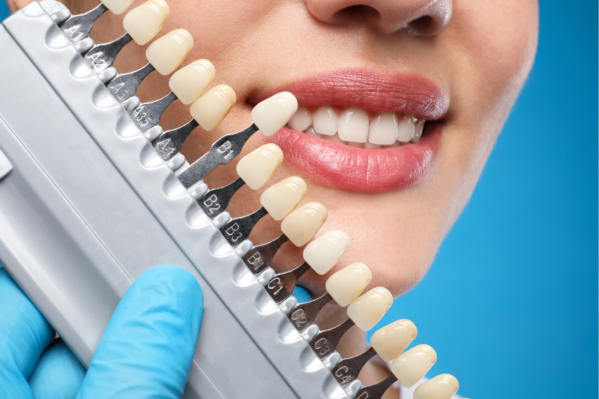 best dental clinic in Khajaguda